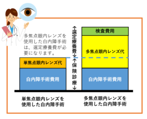 単焦点レンズと多焦点レンズの費用感を比較したグラフです。